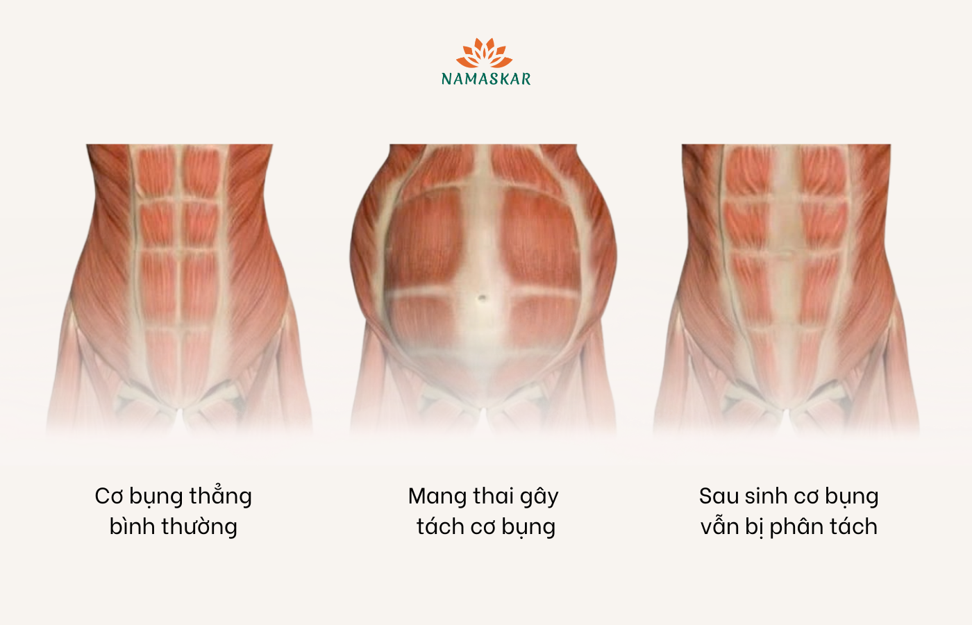 1773399086407 yoga sau sinh san chau co the